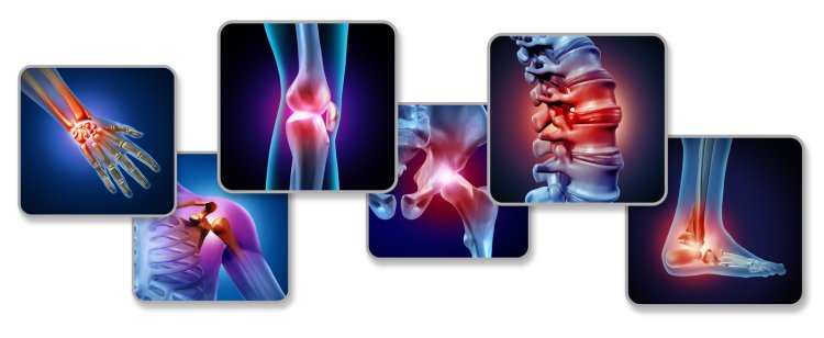 Managing Pain with SOMA 350mg: An Expert’s Insigh