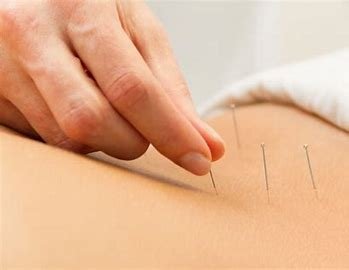 Hidden Costs of Acupuncture Treatments: What You Need to Know